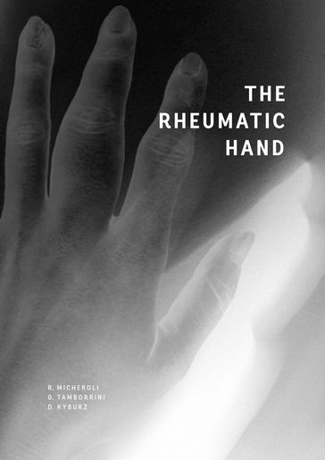 The Rheumatic Hand - Diego Kyburz - Giorgio Tamborrini - Raphael Micheroli