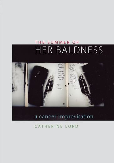 The Summer of Her Baldness - Catherine Lord