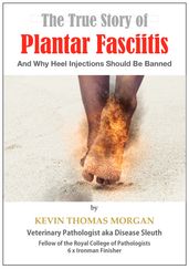 The True Story of Plantar Fasciitis