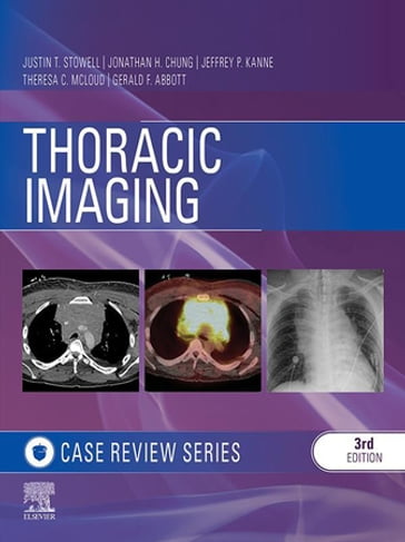 Thoracic Imaging: Case Review Series - MD Gerald F. Abbott - MD Theresa C. McLoud - MD Justin T. Stowell - MD Jonathan H. Chung - MD  Jeffrey P Kanne