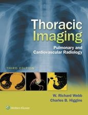 Thoracic Imaging