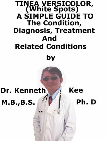 Tinea Versicolor, (White Spots) A Simple Guide To The Condition, Diagnosis, Treatment And Related Conditions - Kenneth Kee