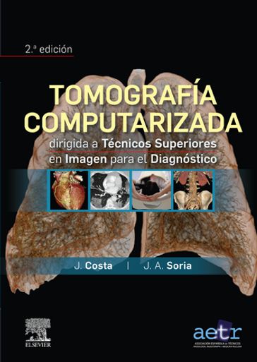 Tomografía computarizada dirigida a técnicos superiores en imagen para el diagnóstico - Joaquín Costa Subias - Juan Alfonso Soria Jerez