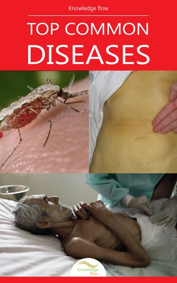 Top Common Diseases - Knowledge flow