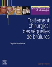 Traitement chirurgical des séquelles de brûlures