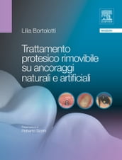 Trattamento protesico rimovibile su ancoraggi naturali e artificiali