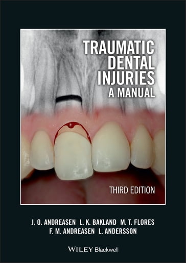 Traumatic Dental Injuries - Jens O. Andreasen - Leif K. Bakland - Maria Teresa Flores - Frances M. Andreasen - Lars Andersson