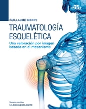 Traumatología esquelética. Una valoración por imagen basada en el mecanismo