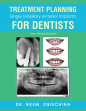 Treatment Planning Single Maxillary Anterior Implants for Dentists