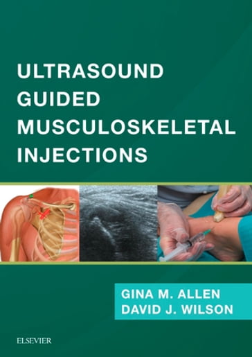 Ultrasound Guided Musculoskeletal Injections E-Book - MBBS  BSc  MFSEM  FRCP  FRCR David John Wilson - BM  DCH  MRCGP  MRCP  FRCR  MFSEM  DipESSR  MScSEM Gina M Allen