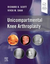 Unicompartmental Knee Arthroplasty, E-Book