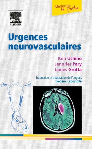 Urgences neurovasculaires - Ken Uchino - Frédéric Lapostolle - Jennifer Pary - MD James C. Grotta - Cambridge University Press