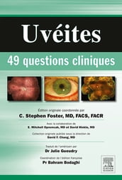 Uvéites : 49 questions cliniques