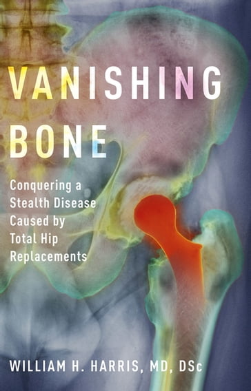 Vanishing Bone - William H. Harris - MD - DSc