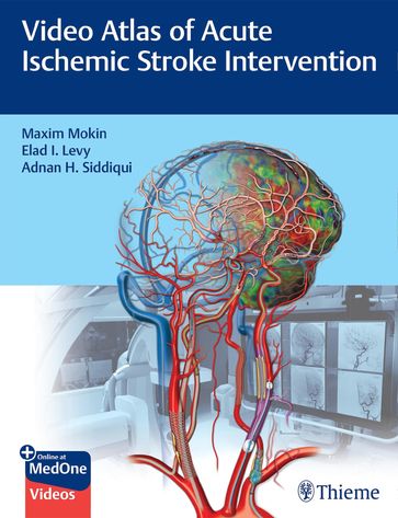 Video Atlas of Acute Ischemic Stroke Intervention - Maxim Mokin - Elad Levy - Adnan Siddiqui
