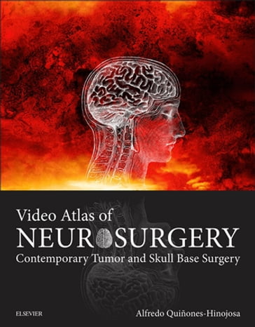 Video Atlas of Neurosurgery E-Book - Alfredo Quinones-Hinojosa - MD - FAANS - FACS