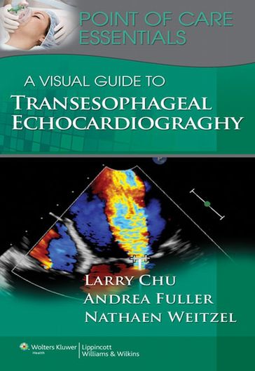 A Visual Guide to Transesophageal Echocardiography - Andrea Fuller - Nathaen Weitzel - Larry F. Chu