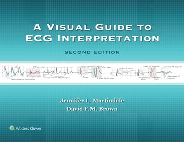 A Visual Guide to ECG Interpretation - David F. Brown - Jennifer L. Martindale