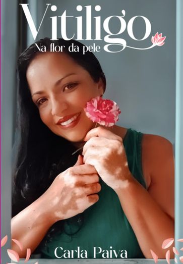 Vitiligo Na Flor Da Pele - Carla Paiva