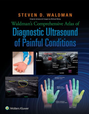 Waldman's Comprehensive Atlas of Diagnostic Ultrasound of Painful Conditions - Steven Waldman