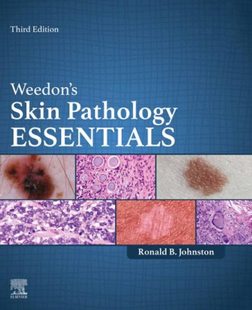 Weedon's Skin Pathology Essentials - E-Book - MD Ronald Johnston
