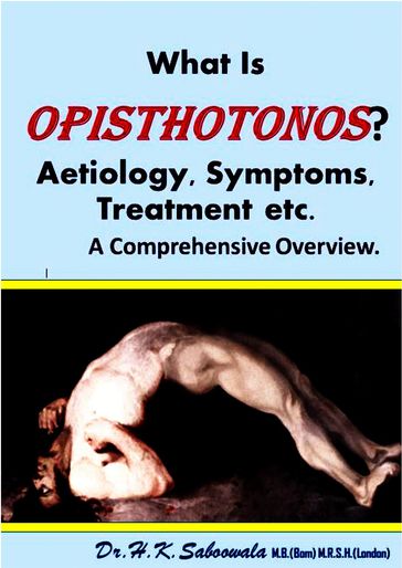 What Is Opisthotonos? Aetiology, Symptoms, Treatment etc. A Comprehensive Overview - Dr. Hakim. K. Saboowala