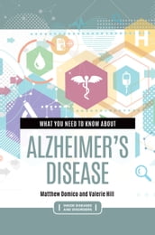 What You Need to Know about Alzheimer s Disease