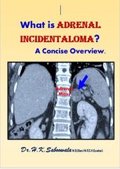 What is ADRENAL INCIDENTALOMA? A Concise Overview