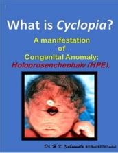 What is Cyclopia ? A manifestation of Congenital Anomaly: Holoprosenchephaly (HPE)