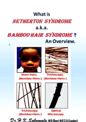 What is Netherton Syndrome a.k.a. Bamboo Hair Syndrome