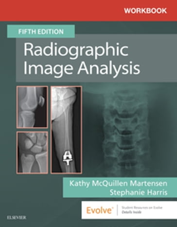 Workbook for Radiographic Image Analysis E-Book - Kathy McQuillen-Martensen - Ma - RT(R)