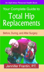 Your Complete Guide to Total Hip Replacements: Before, During, and After Surgery