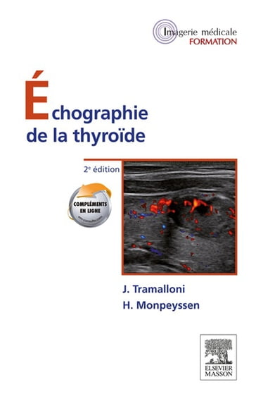 Échographie de la thyroïde - Jean Tramalloni - Hervé Monpeyssen - Michel BLERY