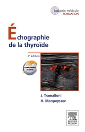 Échographie de la thyroïde