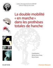 La double mobilité en marche dans les prothèses totales de hanche