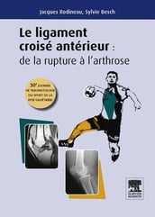 Le ligament croisé antérieur : de la rupture à l arthrose