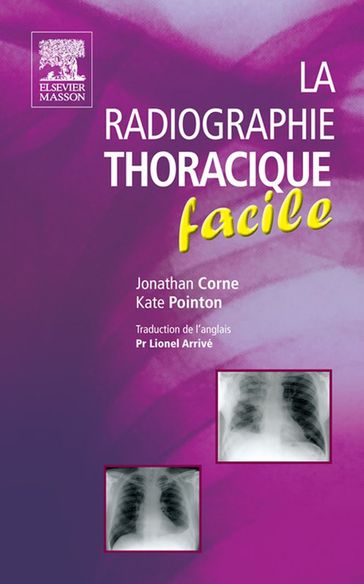 La radiographie thoracique facile - John Scott & Co - MRCP  FRCR Kate Pointon - Lionel Arrivé - MA  PhD  MB BS  FRCP Jonathan Corne